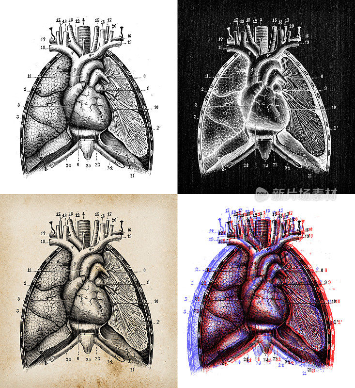 古董插图:器官