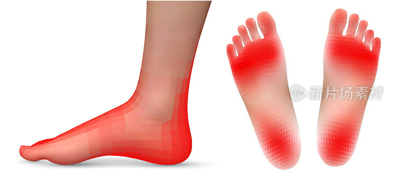 矢量组的腿与白色背景上的红色疼痛斑块