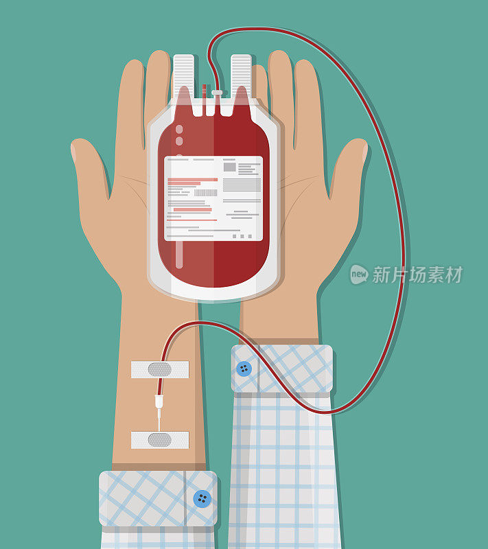 血袋及献血者之手。捐赠的概念