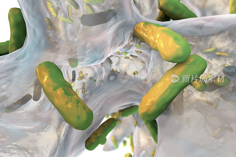 耐药细菌铜绿假单胞菌的生物膜