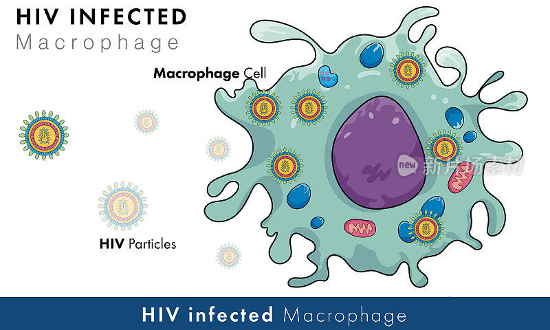 白色背景的HIV感染巨噬细胞载体，病毒感染细胞。
