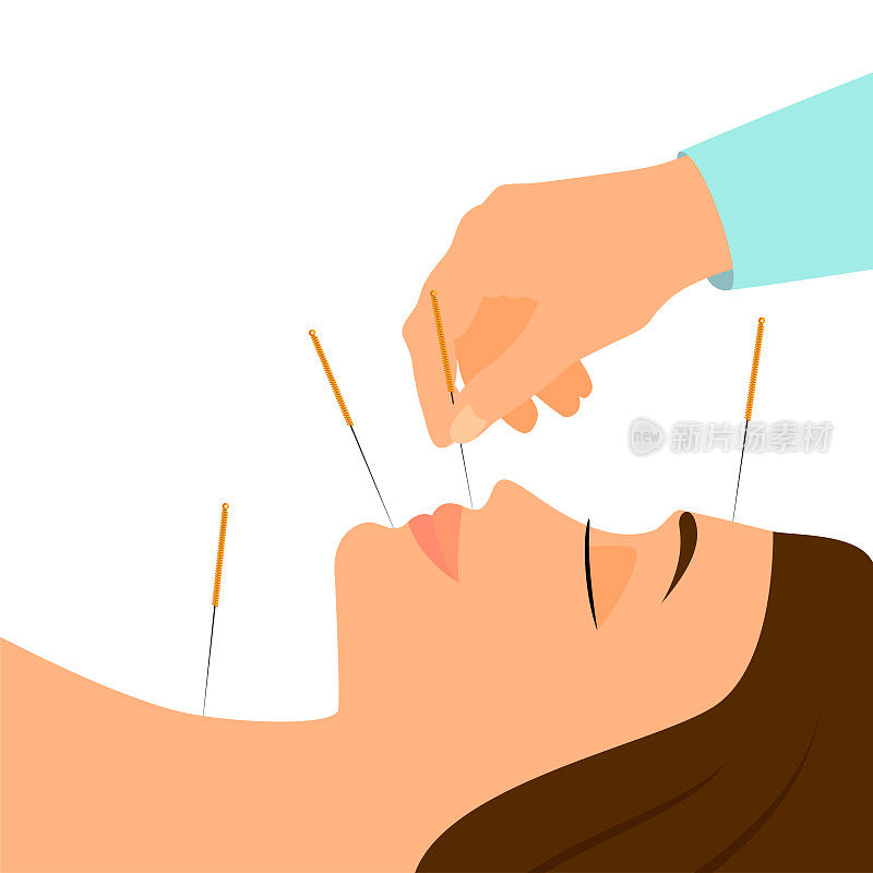 针灸横幅上有女人的脸和中国针。替代医疗保健和医药海报模板。医疗矢量图