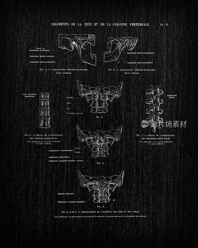 人体解剖学插图从古董法国艺术书:颈部韧带