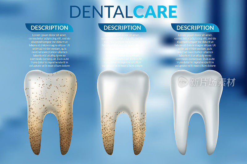 牙齿美白3d概念。美白前后清洁牙与脏牙的比较。牙齿美白程序，牙科保健和口腔卫生海报设计