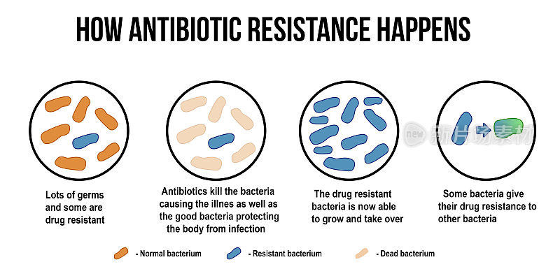 抗生素耐药性如何发生示意图(用于基础医学教育、诊所和学校)