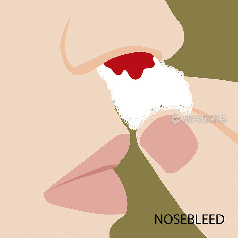 流鼻血时使用纸巾止血，图示为平面设计