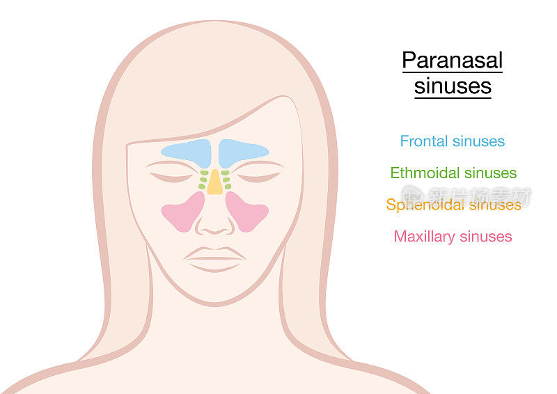 鼻旁窦在妇女脸上的不同颜色-额窦，筛窦，蝶窦和上颌窦。孤立的矢量插图上的白色背景。