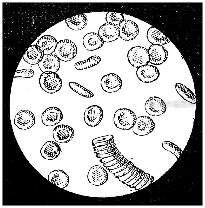 古董插图:血细胞