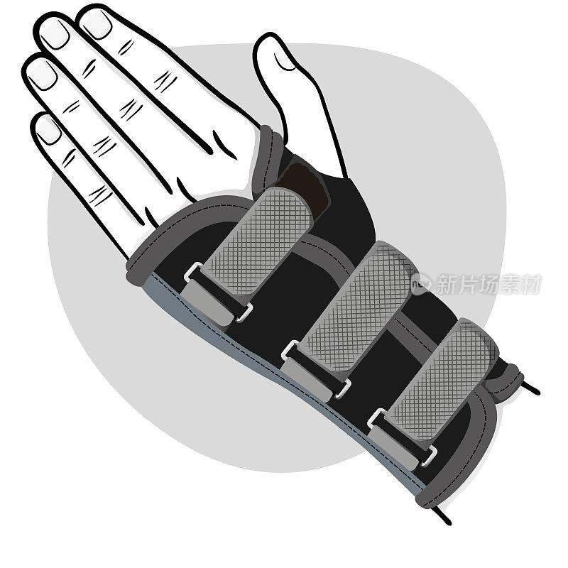 插图代表一只手与手腕，肌腱炎，黑色和白色。理想的培训和机构材料