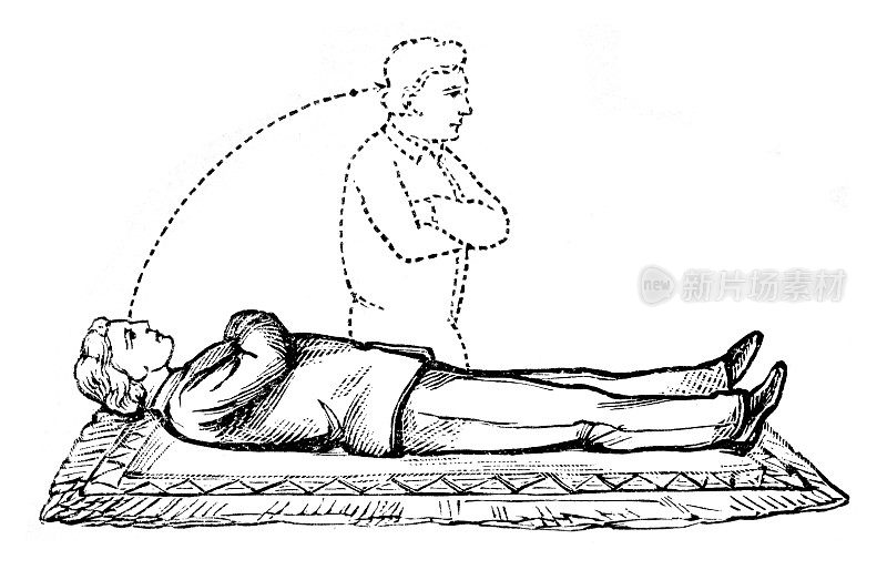 体操康复练习1896年