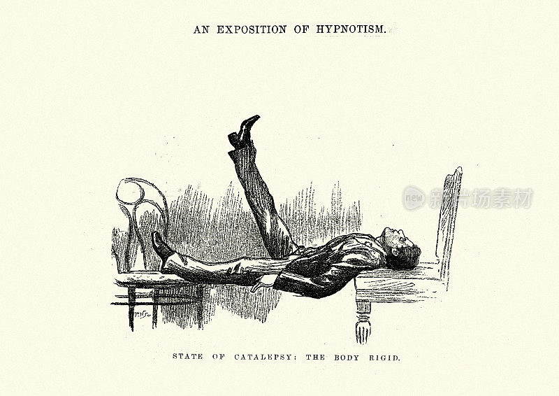催眠，维多利亚时代的麻痹状态，身体僵直地坐在椅子之间