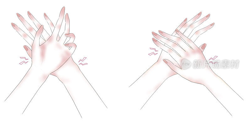 手部皲裂发炎发红的图示(二)