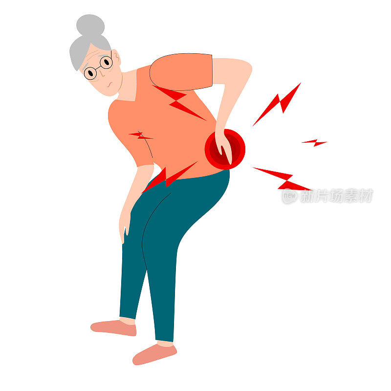 一位老年妇女患有腰椎间盘突出引起的腰痛和坐骨神经痛。医学上关于神经阻滞的图解使病人慢性背痛和瘫痪。矢量插图。