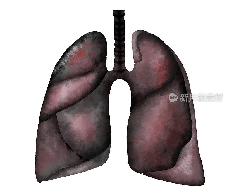 白色背景的人类肺部受疾病影响的插图