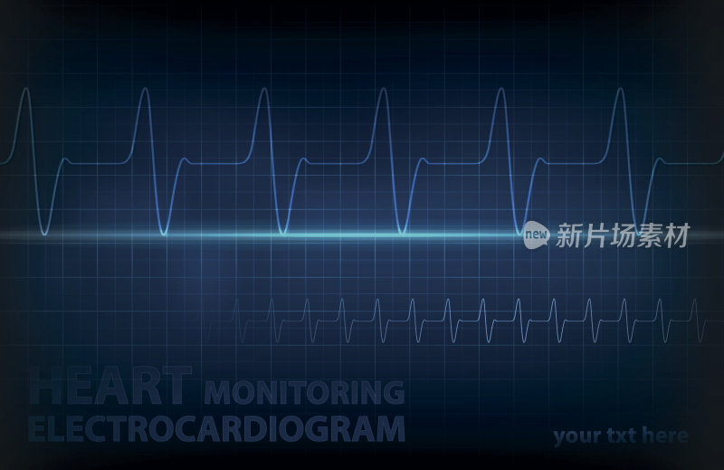 心电心脏监测-医学背景