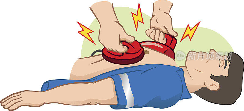 使用除颤器的急救复苏(CPR)