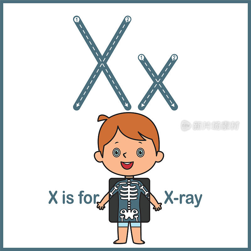 抽认卡上的字母X是X射线矢量插图