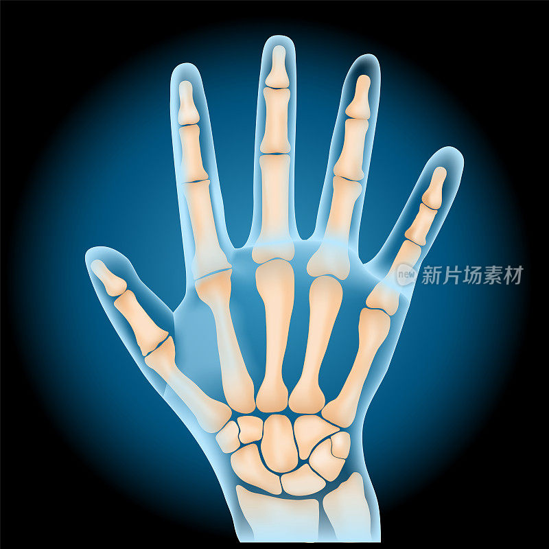 腕的骨头。x射线蓝色逼真的手掌在黑暗的背景。