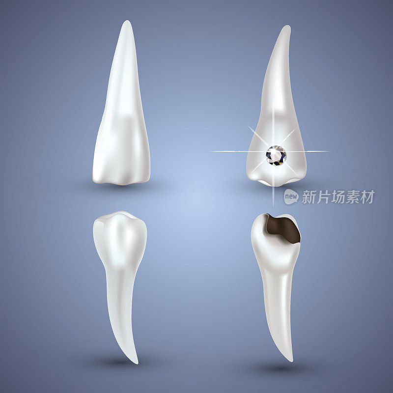 向量集的3d现实清洁和肮脏的牙齿孤立在灰色的背景。牙齿健康的概念。口腔护理，牙齿修复