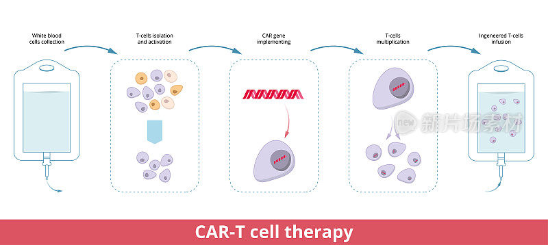 CAR-T细胞疗法