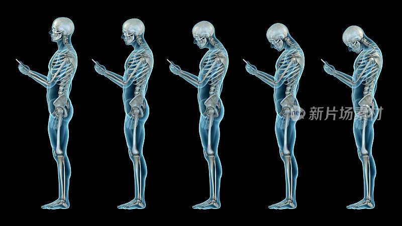 人体解剖显示错误的使用手机姿势