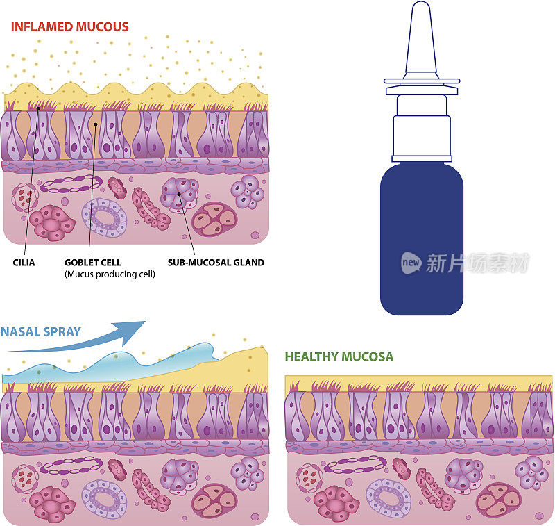 鼻黏膜细胞和微纤毛载体方案