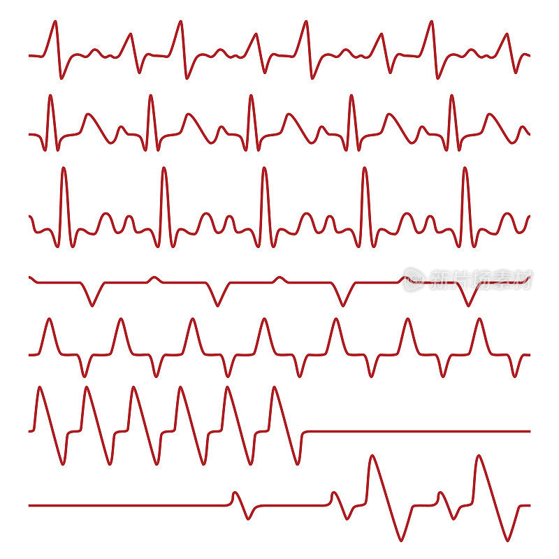 线矢量心电图或心电图在监视器上，心跳医学符号