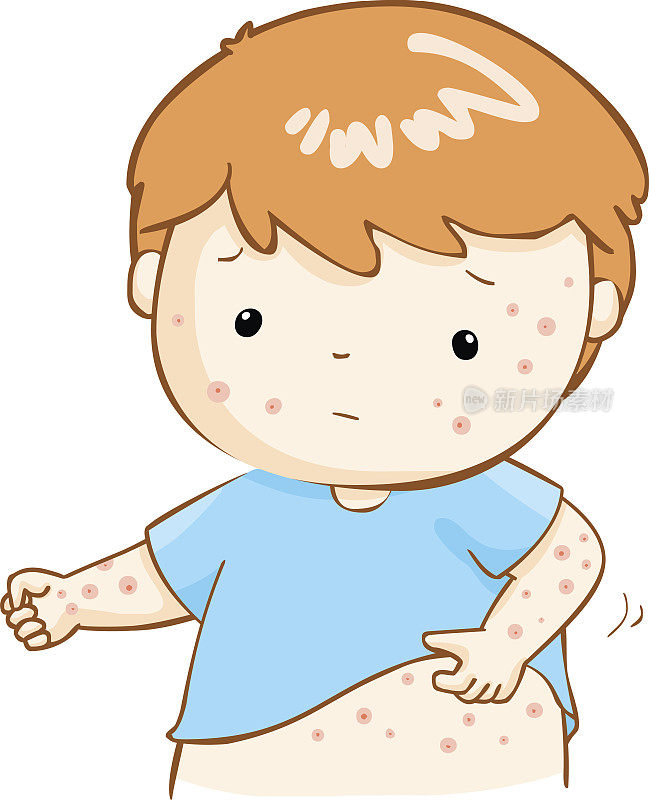 男孩抓痒疹子在他的身体载体