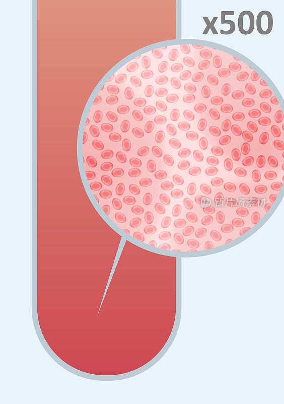 试管中有放大红细胞的血液