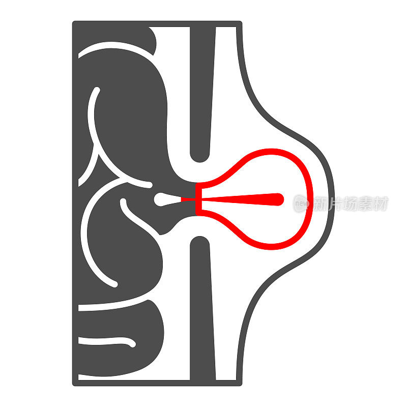 腹股沟疝固体图标，人类疾病概念，疝标志在白色背景，腹膜炎图标字形风格的移动概念和网页设计。矢量图形。