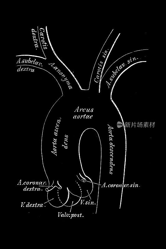 主动脉弓的原始分支