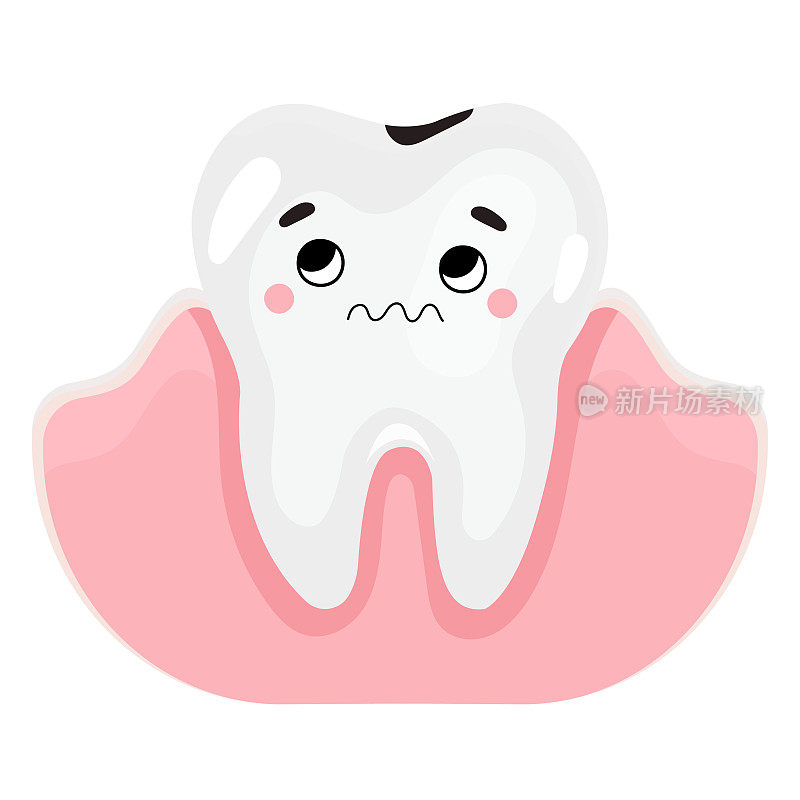 不健康的蛀牙，供牙科诊所使用。