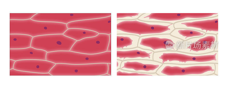 洋葱表皮细胞的胞浆分离