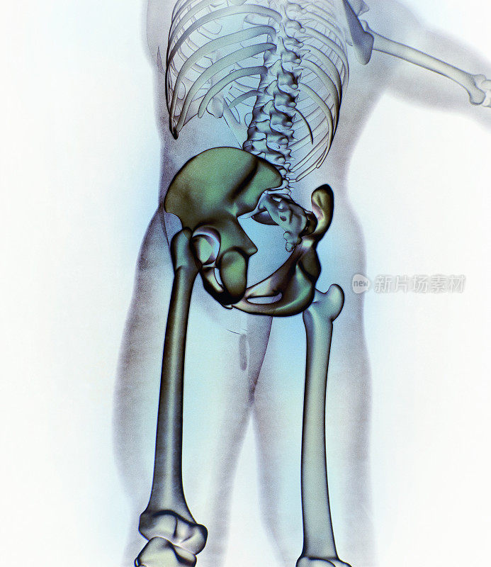 髂骨、髋骨、骨盆。人体解剖学，骨骼结构x光。