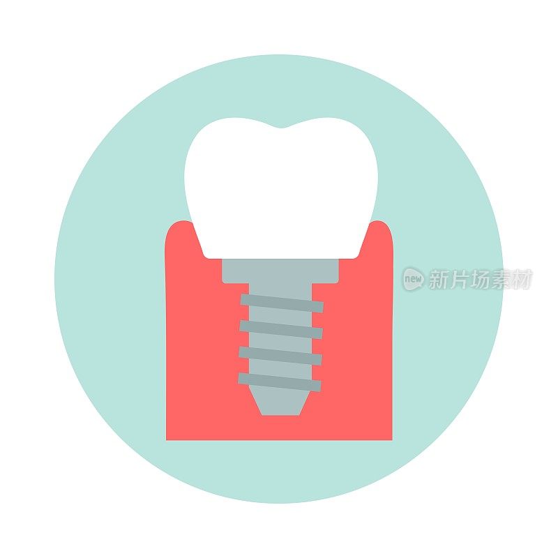 牙科植体图标。牙齿修复的象征。