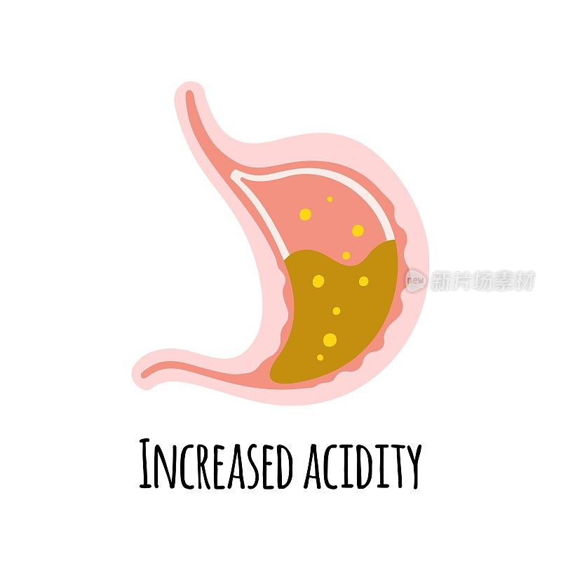 胃酸:酸度高的人的胃胃肠病学。平面风格的矢量插图。