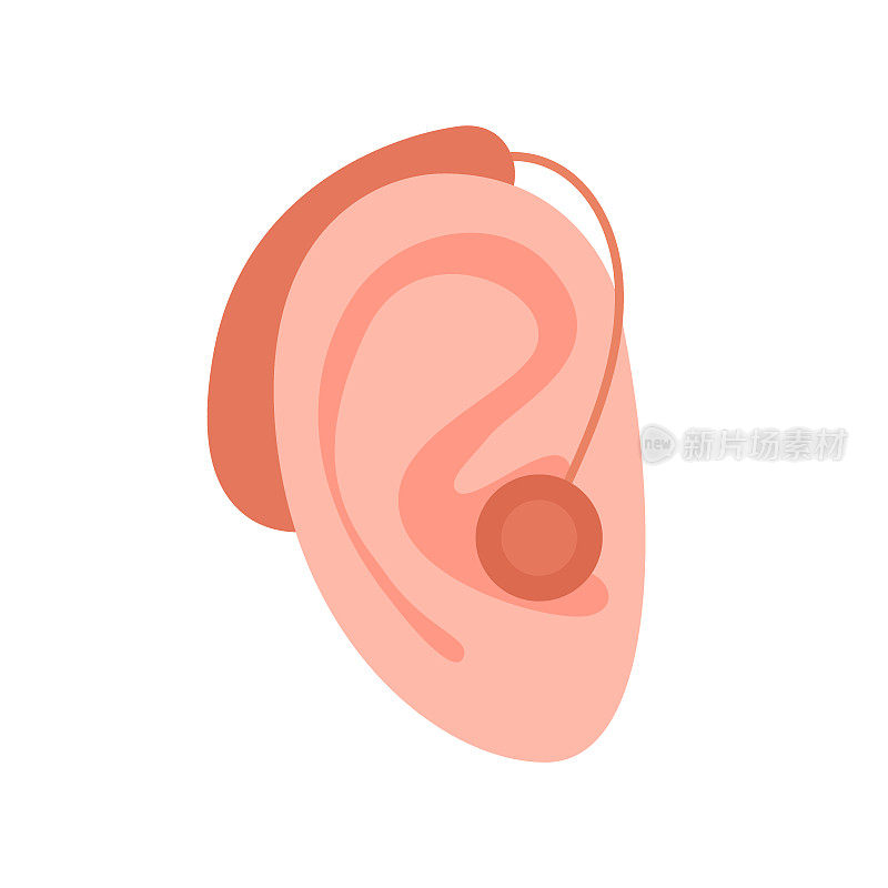 耳用助听器，帮助听力受损人士。耳聋，听力损失。有听力问题的聋子。通过音管恢复听力。向量