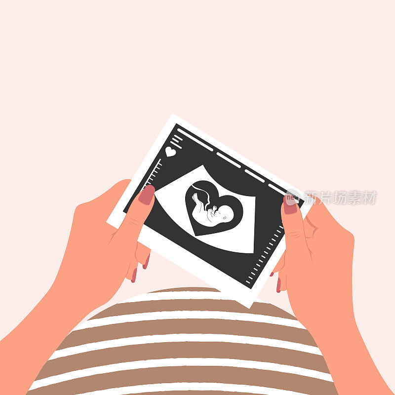 一位快乐的孕妇双手捧着一张胎儿超声波扫描的照片。婴儿的超声波图像。向量