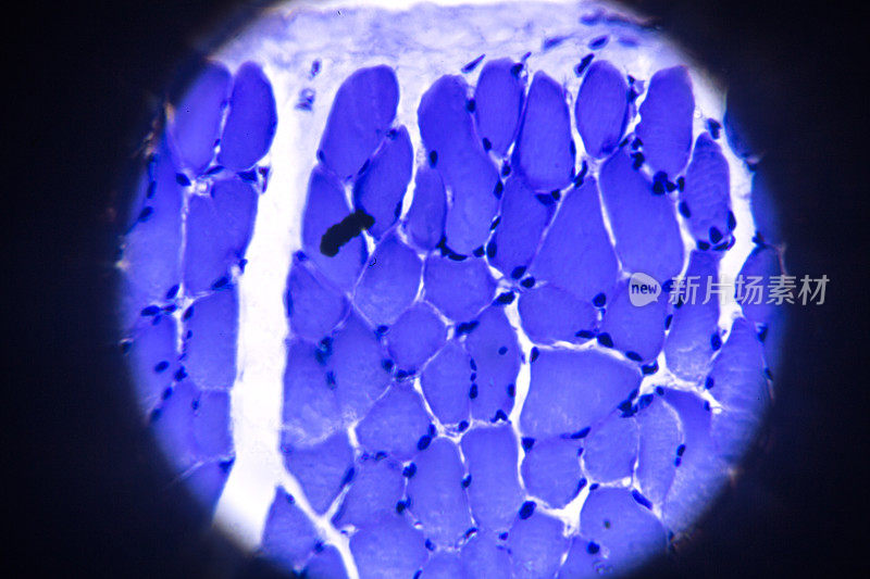 显微镜下骨骼肌横切面