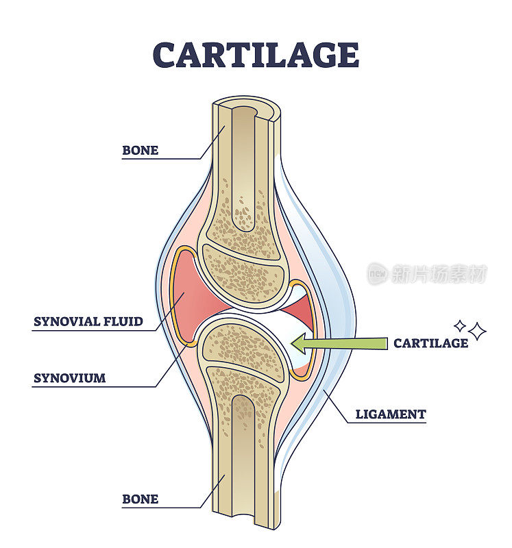 软骨弹性组织在身体和腿部的位置结构示意图