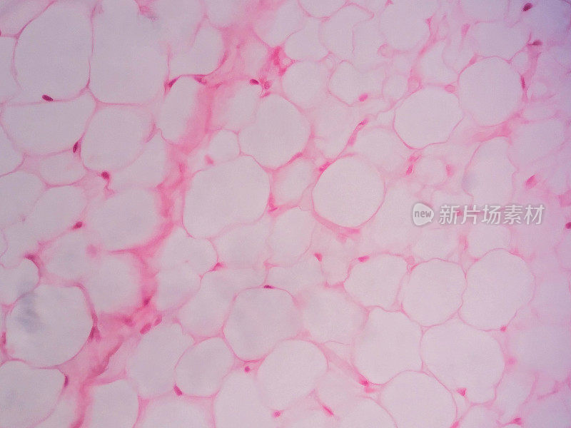 显微镜下观察人体脂肪组织