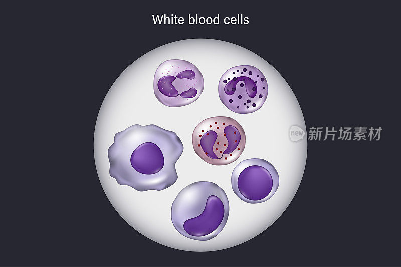 显微镜下的白细胞。中性粒细胞、嗜酸性粒细胞、嗜碱性粒细胞、单核细胞、淋巴细胞和巨噬细胞。