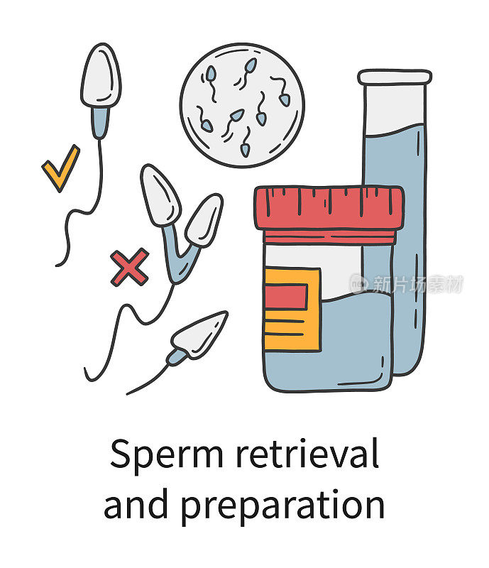 体外受精的精子提取和准备，