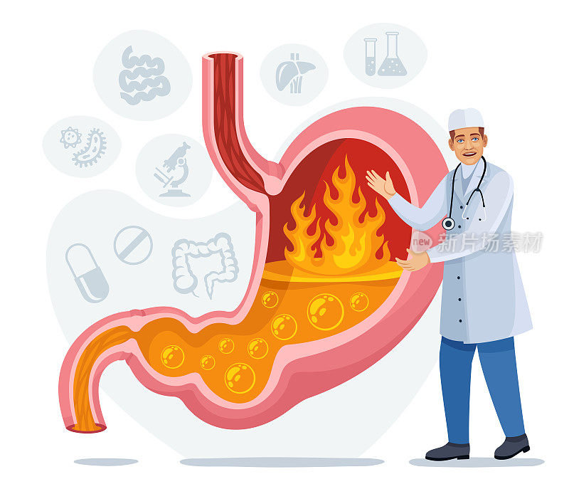 医生说胃灼热。胃肠病学。医学考试。