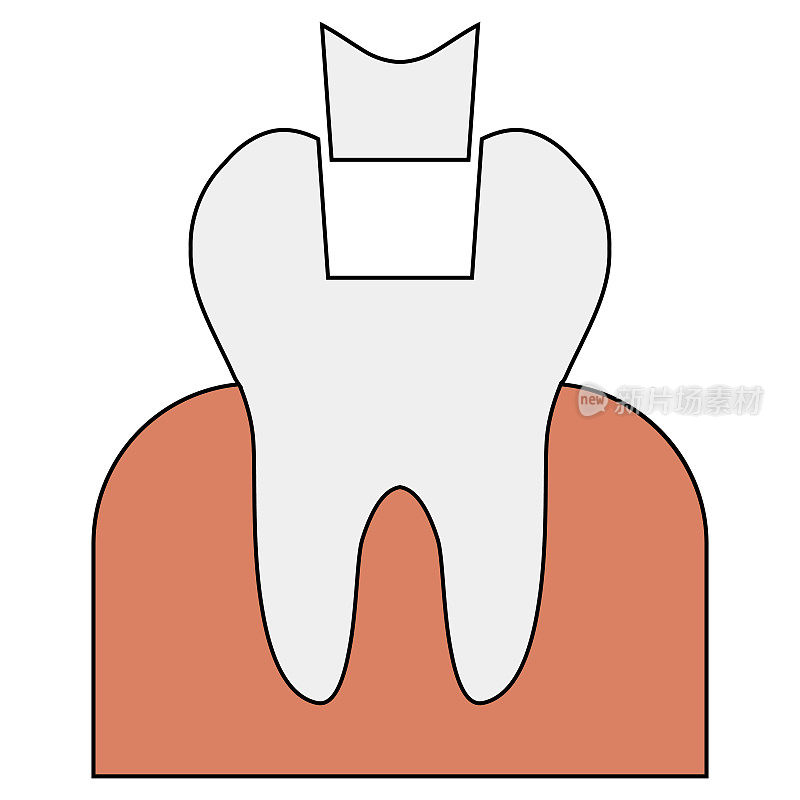 图标填充牙冠修复，信息图填充牙科医生牙医