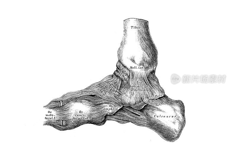 Astragalus-tarsus联合