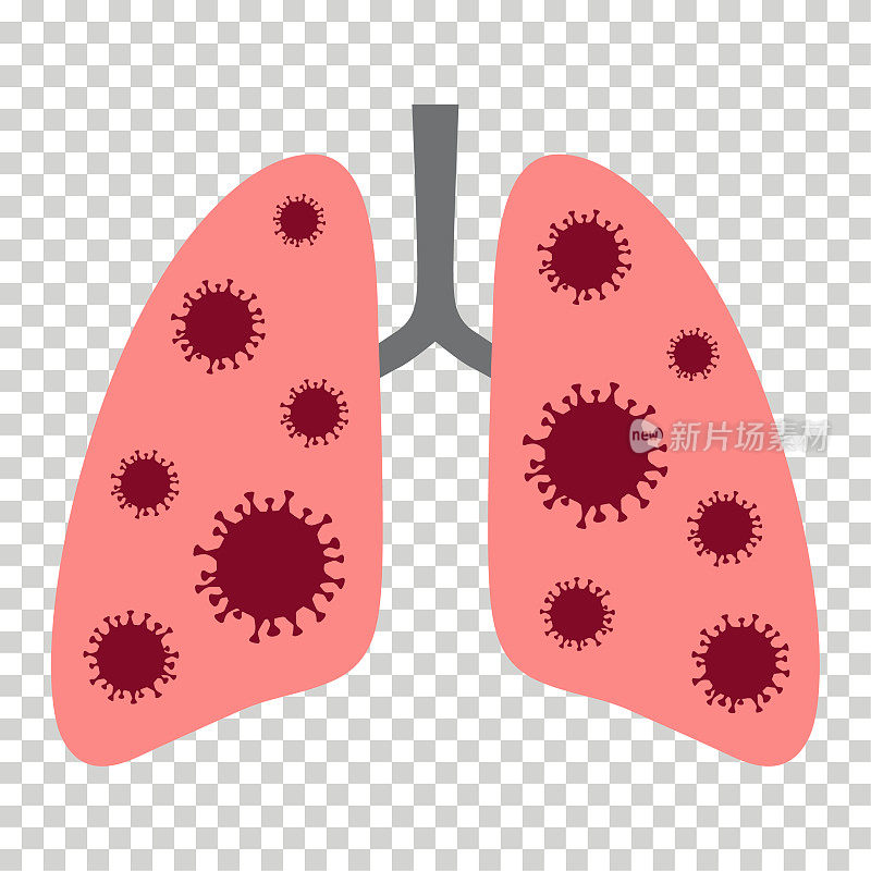 感染冠状病毒的人肺部