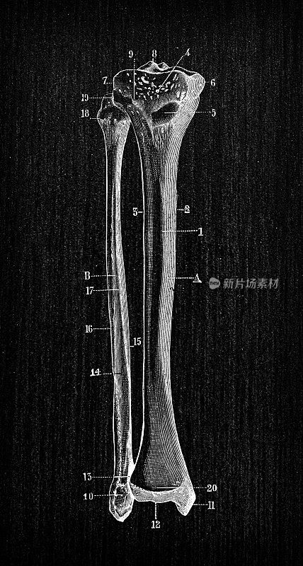 人体解剖骨骼古董插图:胫骨和腓骨