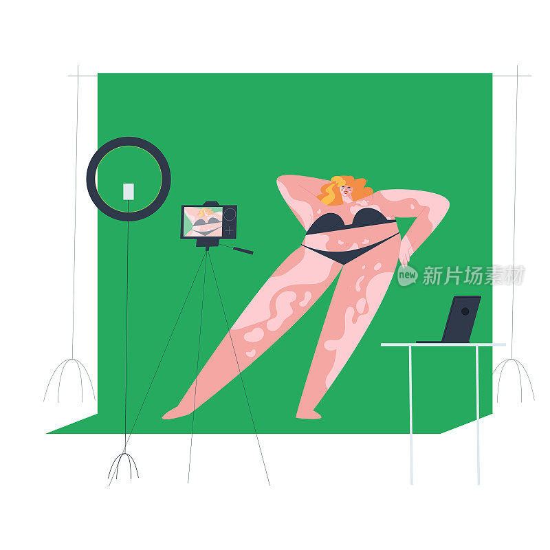一个患有白癜风的女孩模特在摄影棚的绿色背景上摆姿势。大码模特在拍照。