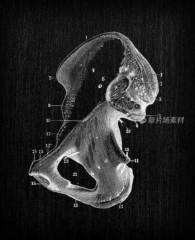 人体解剖骨骼古董插图:髋骨